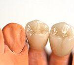 komplexni pece o vase zuby stomatologie Praha